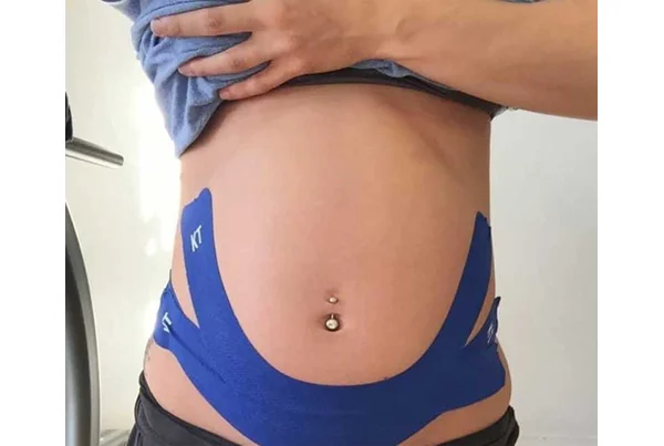 Kinesio Taping