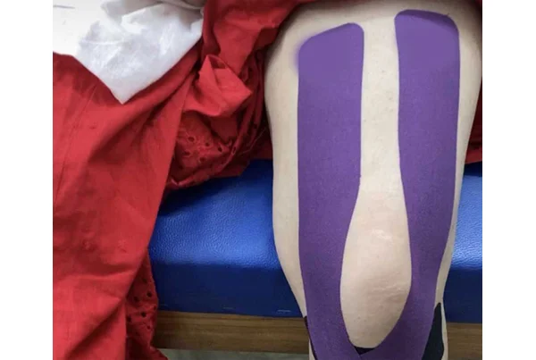 Kinesio Taping