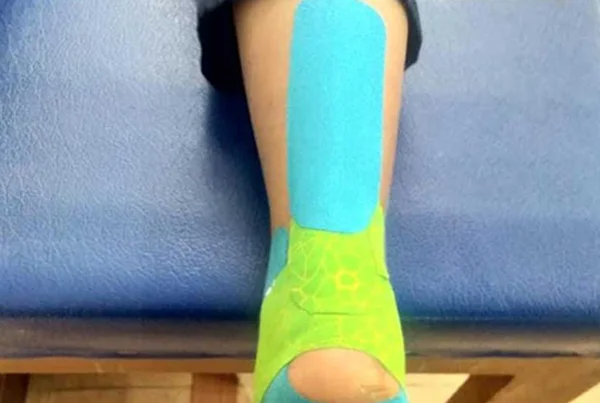 Kinesio Taping