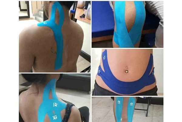 Kinesio Taping