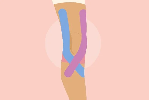 Kinesiology Therapeutic Taping